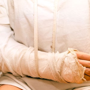 A woman with a cast on her arm, indicating a personal injury.